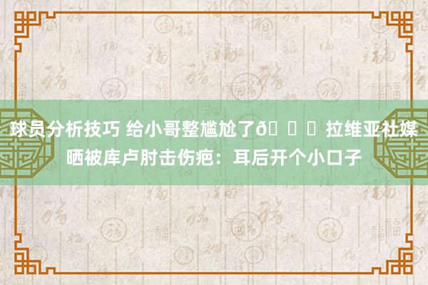 球员分析技巧 给小哥整尴尬了😅拉维亚社媒晒被库卢肘击伤疤：耳后开个小口子